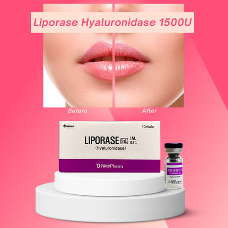 Liporase Hyaluronidase 1500U: Swift and Effective Hyaluronic Acid Filler Dissolver and Fat-Dissolving Injection Enhancer - Filler Lux™