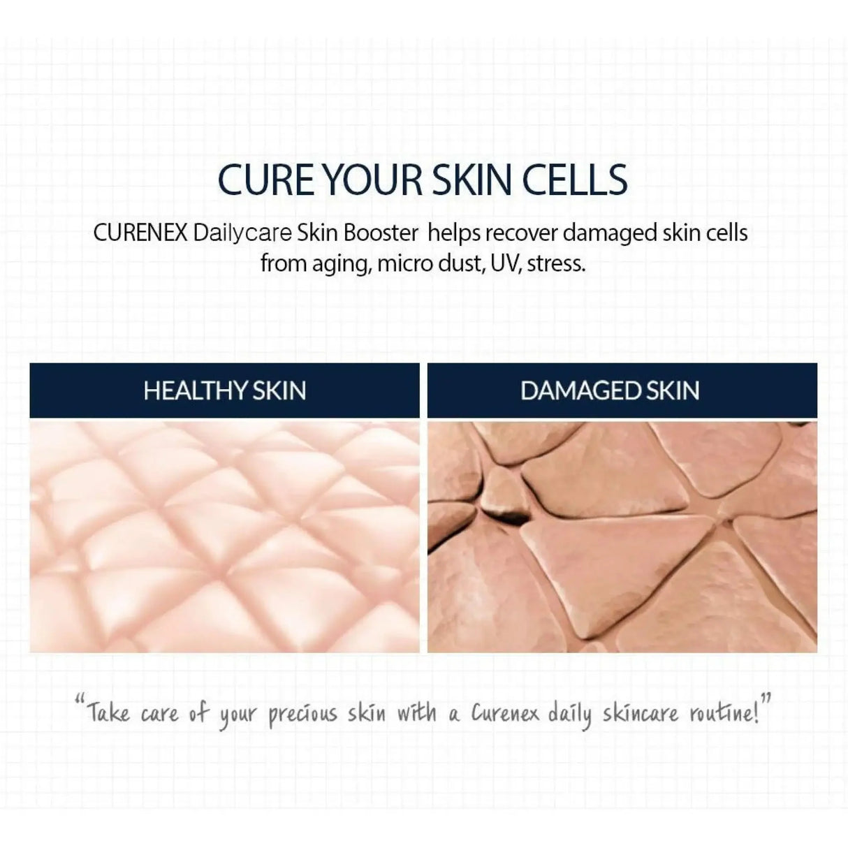 Curenex Dailycare Skinbooster - Filler Lux™ - Clearance - K Derma