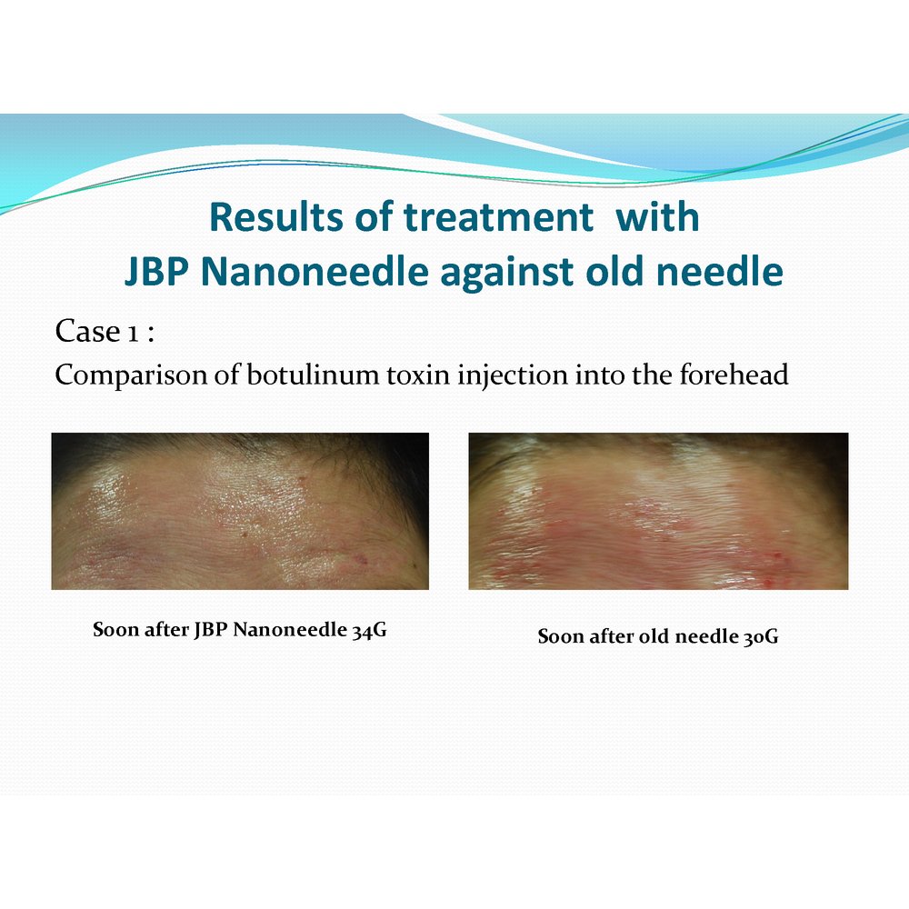 JBP Nanoneedle Premier - Filler Lux™ - Needles - Japan Bio Products Co., Ltd.